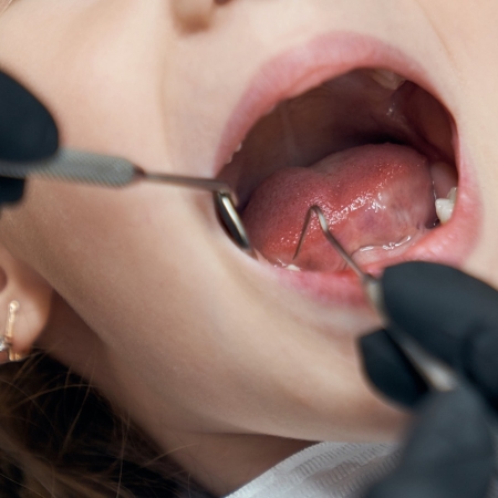 Invisalign First 10 Portrait of pretty bold female child sitting in dental chair with open mouth while professional doctor in rubber gloves carefully examining condition of teeth. Concept of dentistry